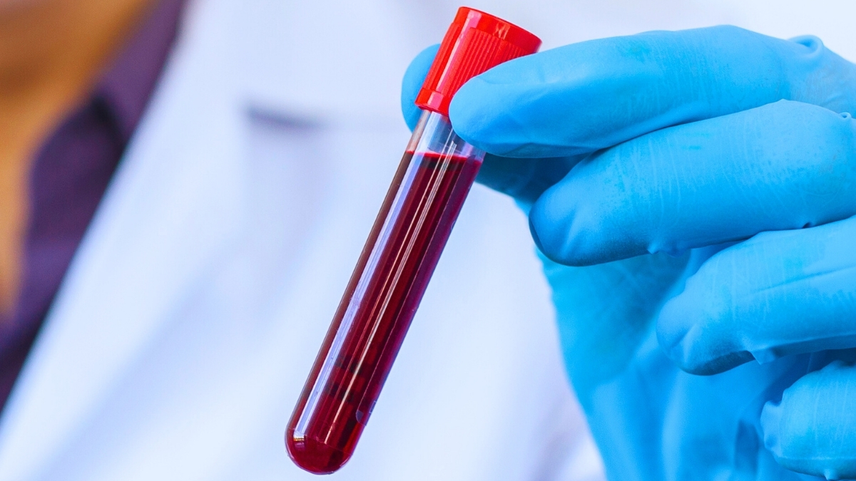 The Blood of Centenarians Reveals 37 Proteins Linked With Slower Aging